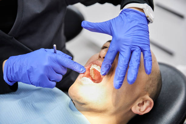 Best Emergency Tooth Extraction in Bar Nunn, WY